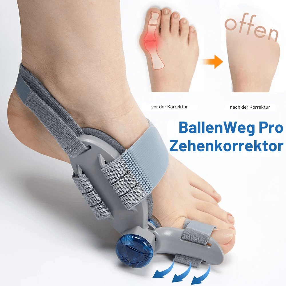 BallenWeg Pro – Sanfte Korrektur bei Hallux Valgus